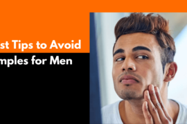 Best Tips to Avoid Pimples for Men